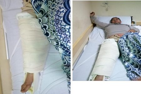 نقابة البيطريين: إصابة بيطرى بكسر مضاعف بعد ركل “عجل” له أثناء مشاركته بحملات التحصين بالفيوم
